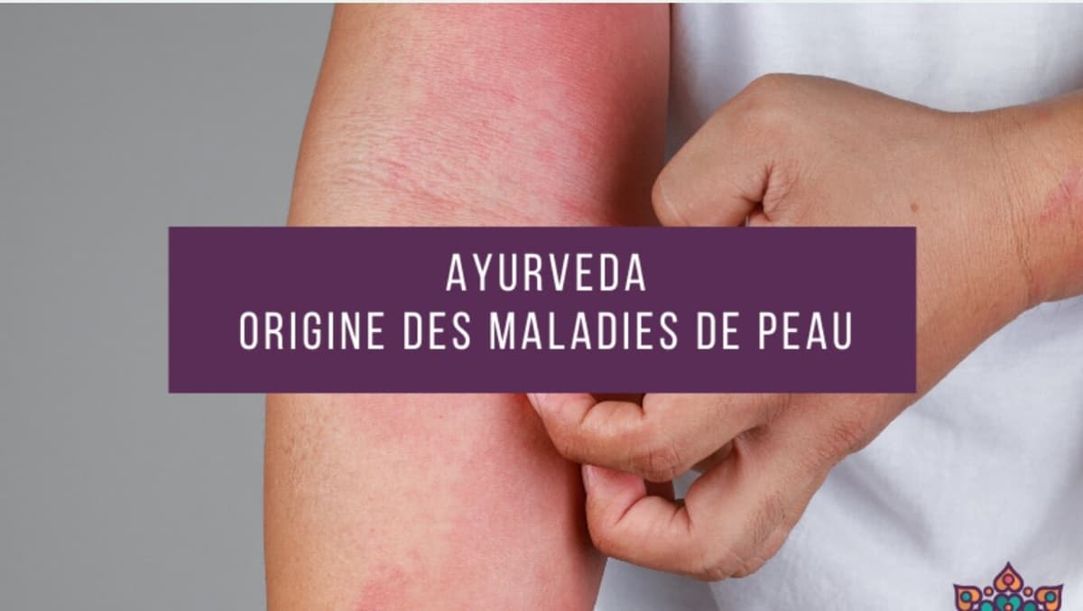 Illustration de l'événement : Atelier découverte - L'origine des maladies de peau selon l'Ayurveda